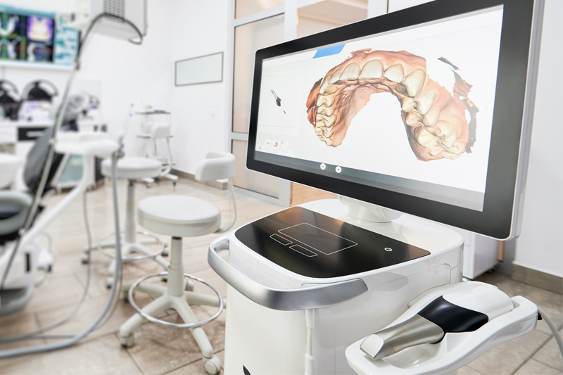 Intra-Oral Scanner in Simsbury